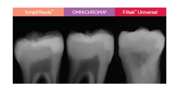 Kerr SimpliShade radiography